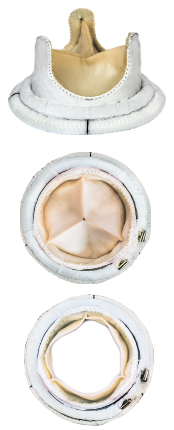 Prosthesis of the heart valve 