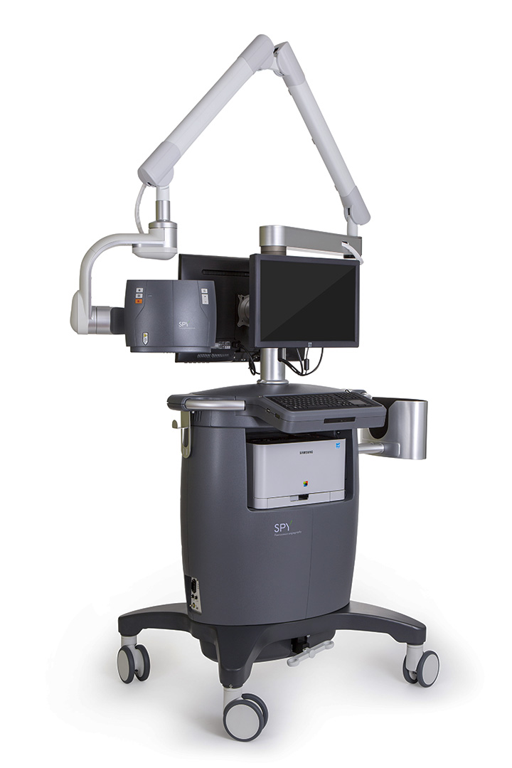 Intraoperative imaging system SPY 3000