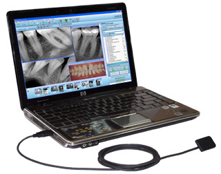 Radiovisiograph (visiograph) dental digital ANVISIOGRAPH