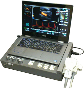 Сканер ультразвуковой ветеринарный ЭТС-Д-05 