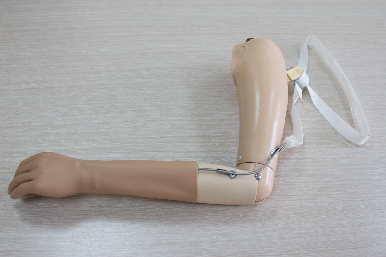 Upper limb prostheses