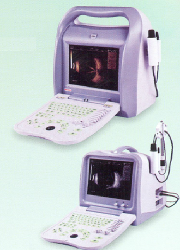 Digital Ophthalmic Ultrasound Scanner