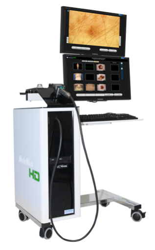 MoleMax HD video dermatoscope